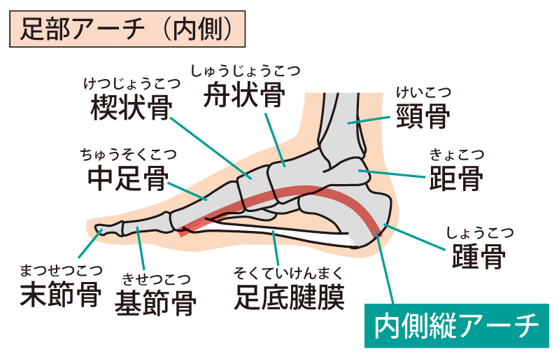 踵の痛みを出す足底腱膜と土踏まずの形状
